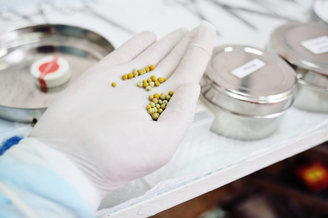 Stones holding a bladder stones from a dog's bladder.
