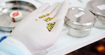Stones holding a bladder stones from a dog's bladder.